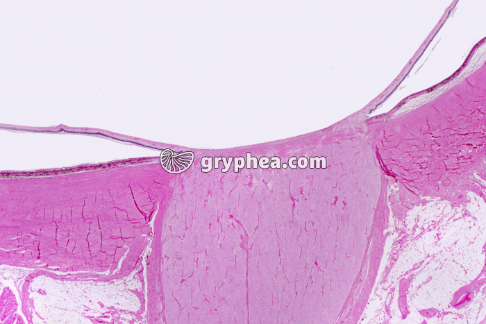 Tache aveugle Nerf optique x1,5 - gryphea.org